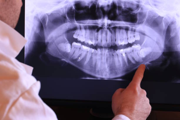 Best Urgent Dental Care for Toothache in Flanders, NJ
