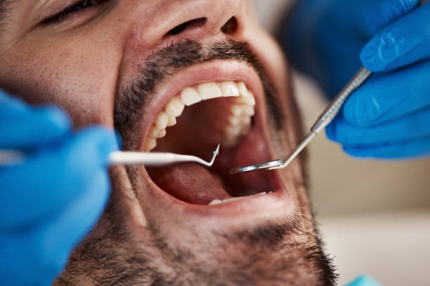 Best Broken or Cracked Tooth Emergency Dentist in Flanders, NJ